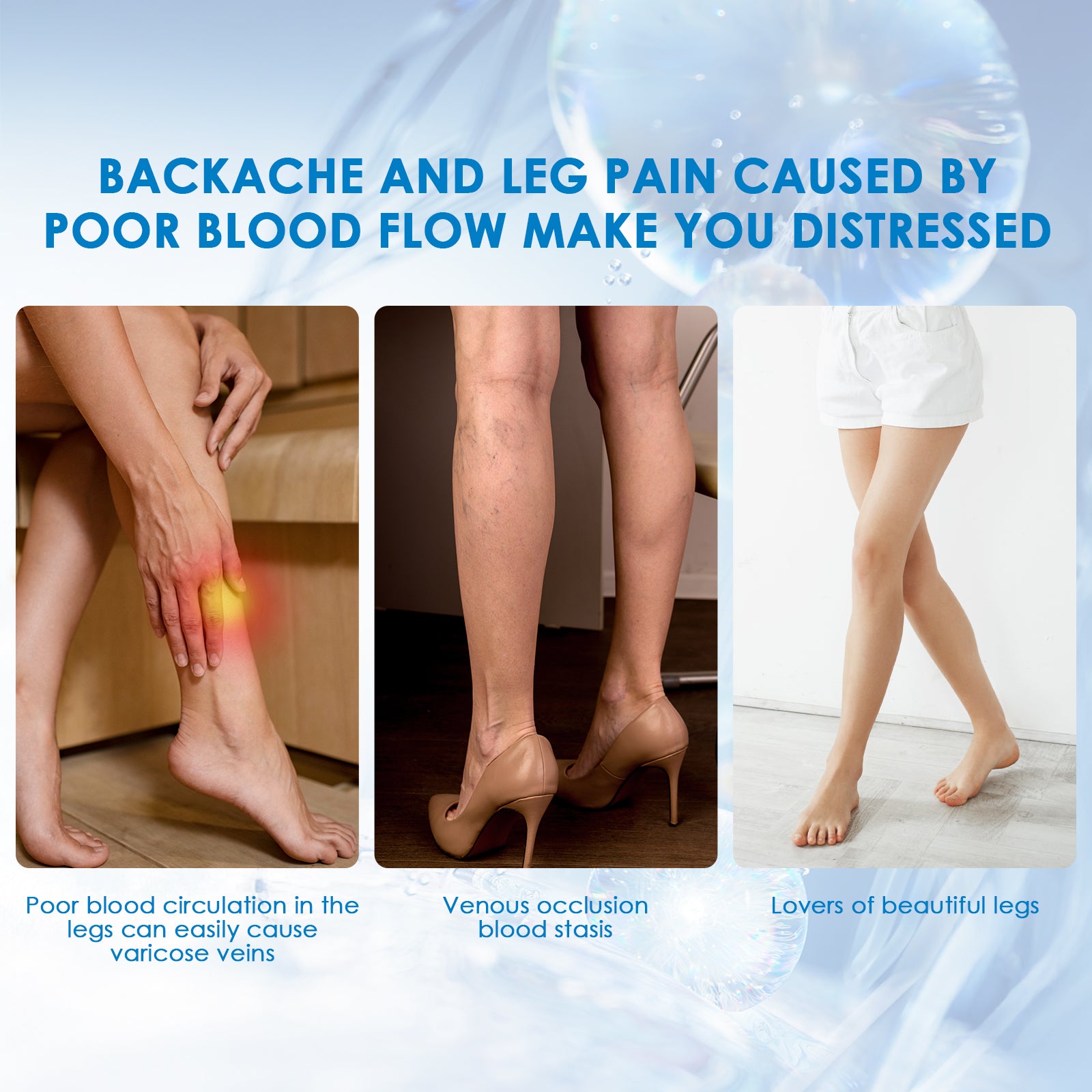 30ml Varicose Vein Spray Multi-Purpose Knee And Leg Care Spray Promote Blood Circulation