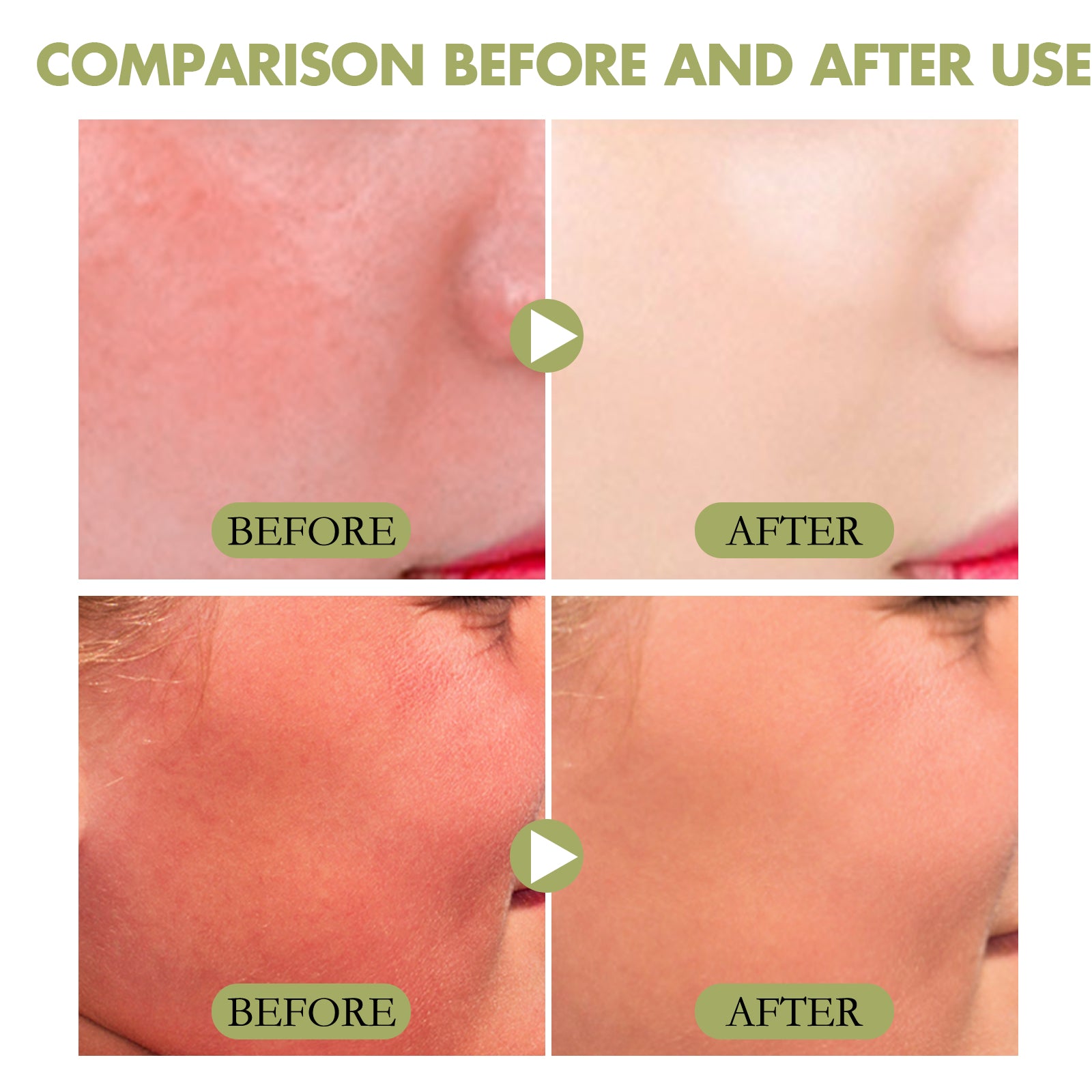 color:All